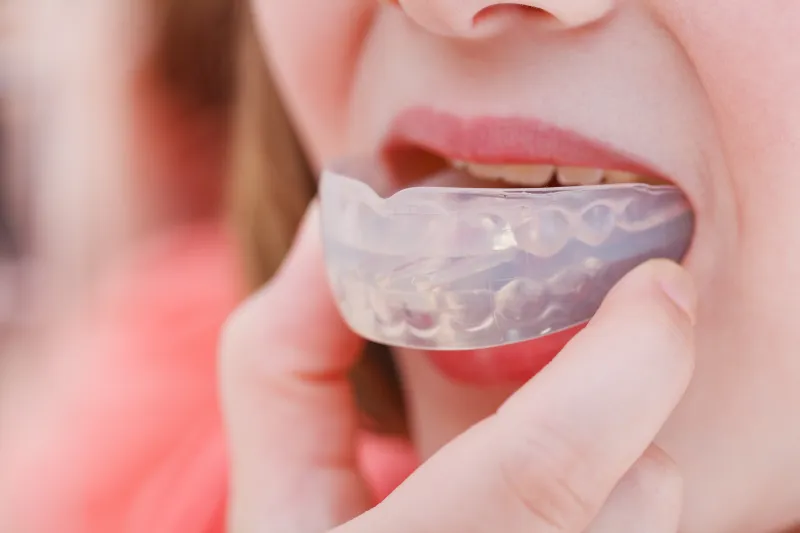 Mouthguards