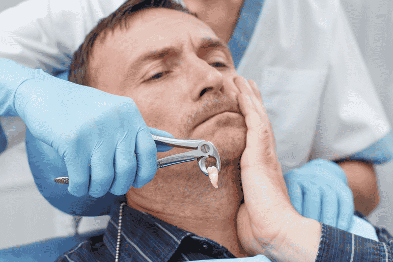 Tooth Extractions